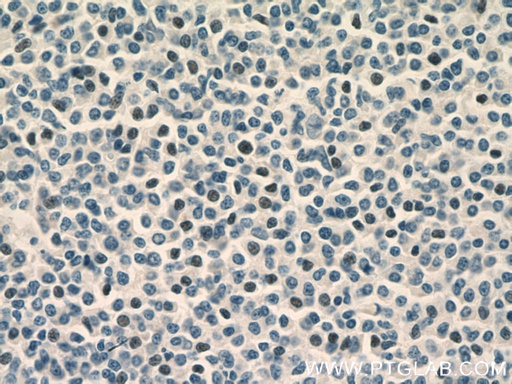[26877-1-AP-150UL] TLX1 Polyclonal antibody