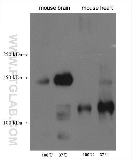 [26883-1-AP-20UL] SLC4A3 Polyclonal antibody