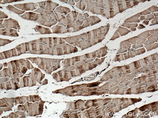 [26888-1-AP-20UL] SCAMP3 Polyclonal antibody