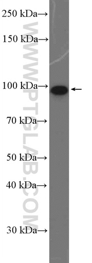[26894-1-AP-20UL] DDX54 Polyclonal antibody