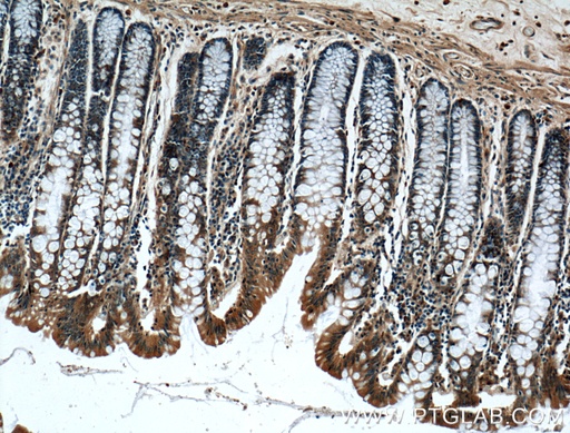 [26896-1-AP-20UL] IFT22 Polyclonal antibody