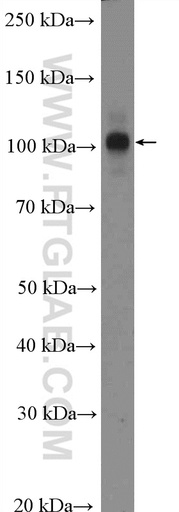 [26898-1-AP-20UL] CWC22 Polyclonal antibody