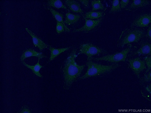 [26905-1-AP-150UL] Neuronatin Polyclonal antibody