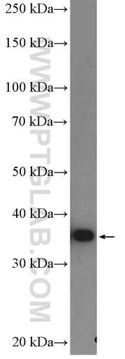 [26907-1-AP-150UL] AMPK Beta 1 Polyclonal antibody