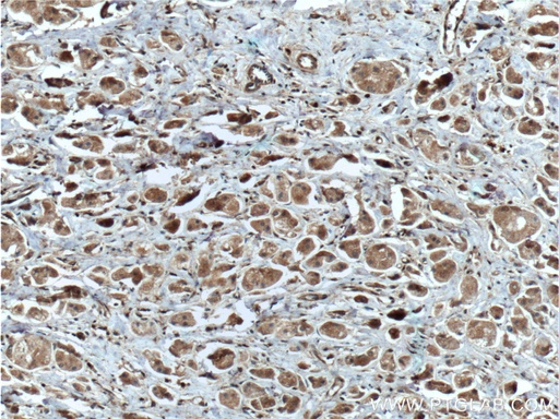 [26910-1-AP-20UL] DUSP7/PYST2 Polyclonal antibody