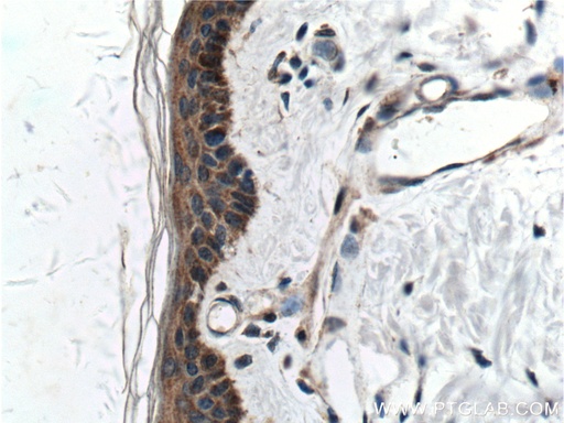 [26918-1-AP-150UL] Integrin Beta 1 Polyclonal antibody