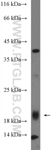 [26921-1-AP-150UL] CXorf38 Polyclonal antibody