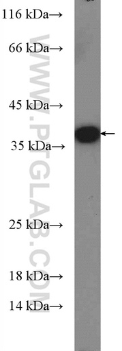 [26927-1-AP-20UL] Sa Cas9 Polyclonal antibody