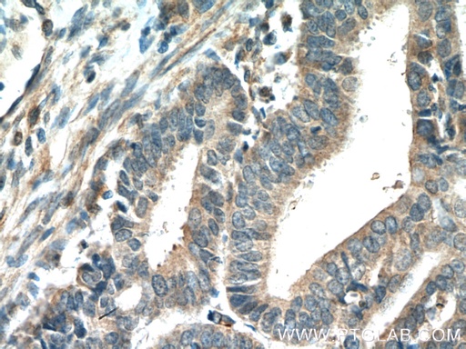 [26928-1-AP-20UL] ADAM12 Polyclonal antibody