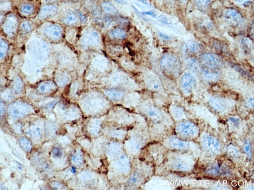 [26941-1-AP-150UL] F11R Polyclonal antibody