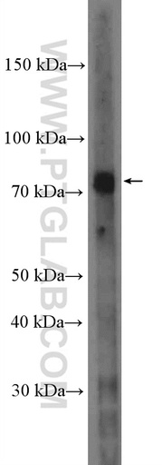 [26944-1-AP-20UL] MTRR Polyclonal antibody