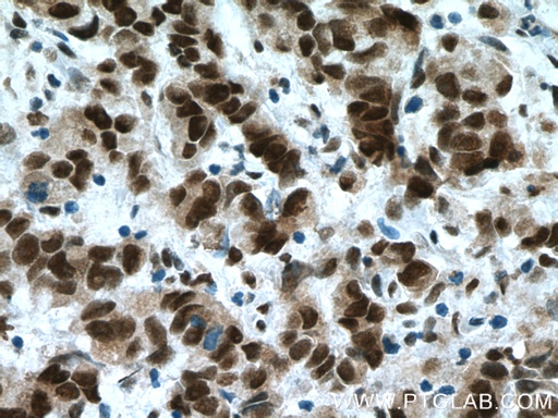 [26948-1-AP-20UL] USP7 Polyclonal antibody