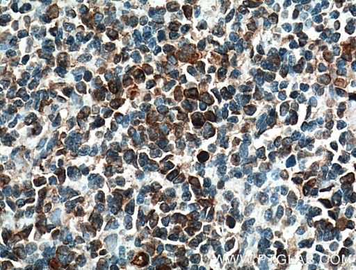 [26949-1-AP-20UL] FCRLA Polyclonal antibody
