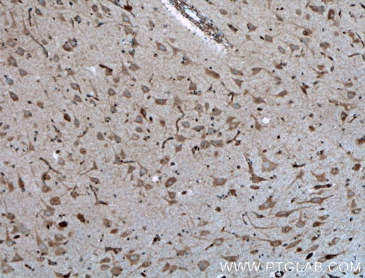 [26950-1-AP-150UL] GNRH1 Polyclonal antibody