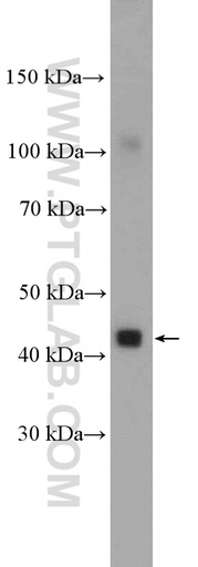 [26953-1-AP-20UL] MCT14 Polyclonal antibody