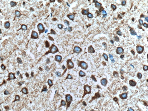 [26968-1-AP-150UL] RYR1 Polyclonal antibody