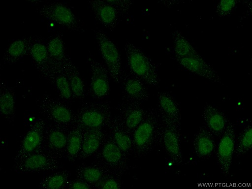 [26971-1-AP-150UL] DNMT3B Polyclonal antibody
