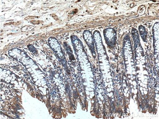 [26972-1-AP-150UL] PAM Polyclonal antibody