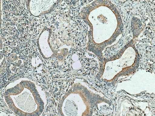 [26979-1-AP-20UL] Cystatin S Polyclonal antibody