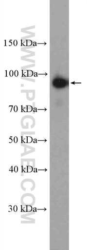 [26985-1-AP-150UL] Calpain 7 Polyclonal antibody