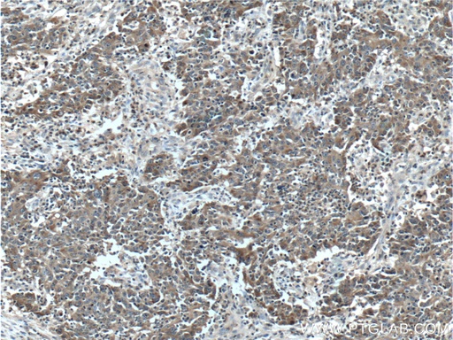 [26991-1-AP-20UL] LCN2 Polyclonal antibody