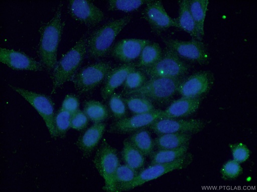 [26992-1-AP-20UL] S100A9 Polyclonal antibody
