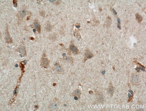 [27003-1-AP-20UL] LRRTM3 Polyclonal antibody
