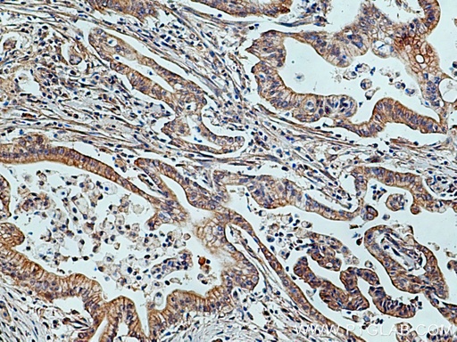 [27013-1-AP-150UL] TRIM26 Polyclonal antibody