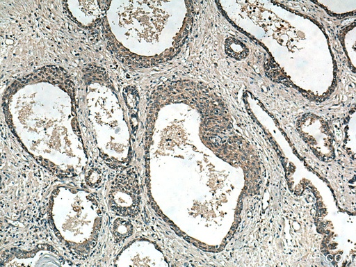 [27018-1-AP-20UL] RNF113A Polyclonal antibody
