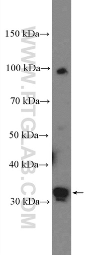 [27024-1-AP-20UL] PRPS2 Polyclonal antibody