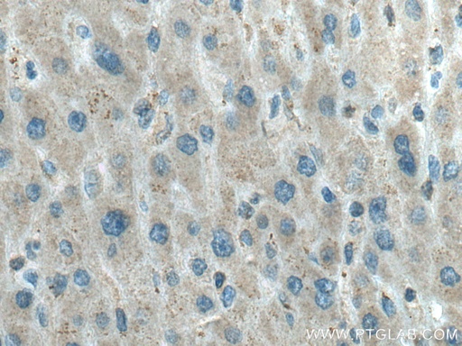 [27026-1-AP-150UL] LPIN1 Polyclonal antibody