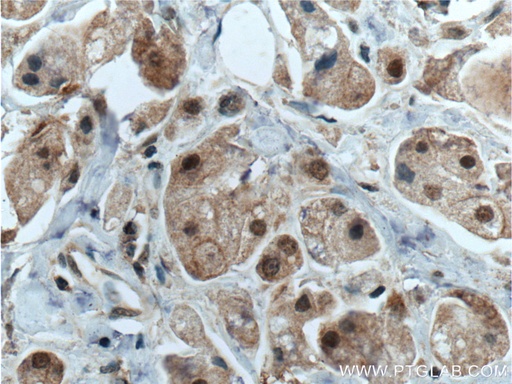 [27027-1-AP-20UL] CDK7 Polyclonal antibody