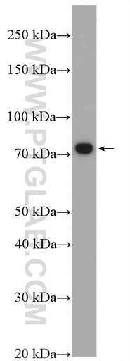 [27028-1-AP-150UL] ERCC6L2 Polyclonal antibody