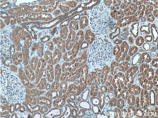 [27035-1-AP-150UL] PI3 Kinase p55 Gamma Polyclonal antibody