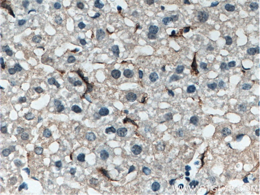 [27044-1-AP-150UL] EMR1 Polyclonal antibody