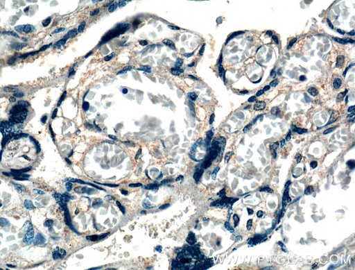 [27049-1-AP-150UL] XKRX Polyclonal antibody