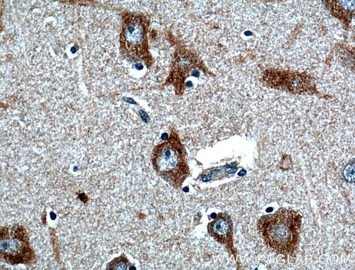 [27051-1-AP-150UL] FIBIN Polyclonal antibody