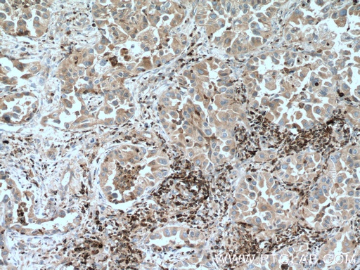 [27056-1-AP-150UL] FBP17 Polyclonal antibody