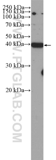 [27058-1-AP-20UL] CDK5R2/p39 Polyclonal antibody