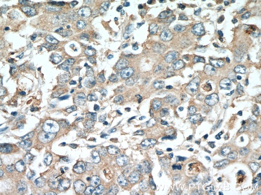[27069-1-AP-150UL] DMBT1 Polyclonal antibody