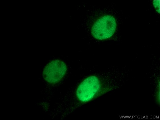 [27071-1-AP-150UL] RAD21 Polyclonal antibody