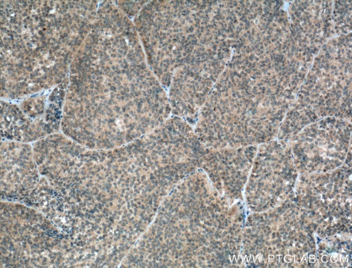 [27079-1-AP-20UL] GH1 Polyclonal antibody