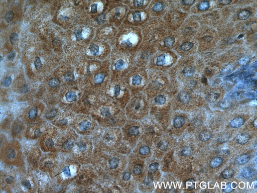 [27080-1-AP-150UL] DKK4 Polyclonal antibody