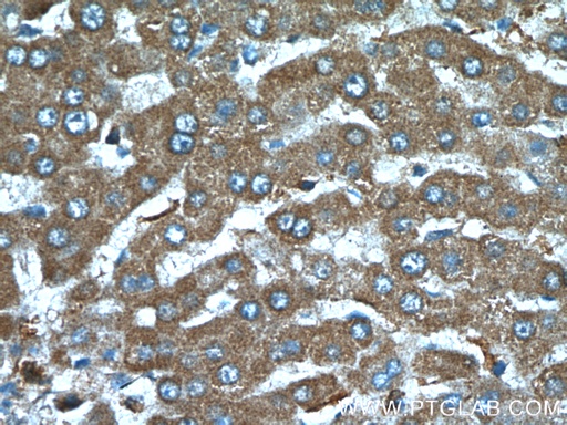 [27081-1-AP-20UL] TTPA Polyclonal antibody