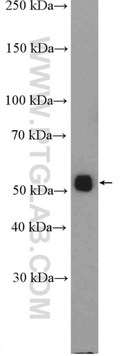 [27085-1-AP-20UL] ALG11 Polyclonal antibody