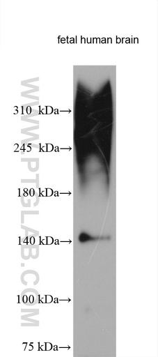 [27087-1-AP-150UL] Neurocan Polyclonal antibody