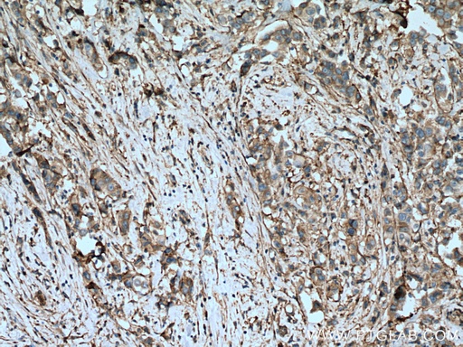 [27096-1-AP-150UL] Integrin Alpha V Polyclonal antibody