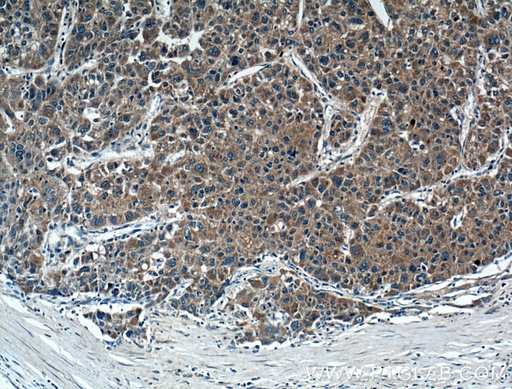 [27100-1-AP-20UL] FGF3 Polyclonal antibody