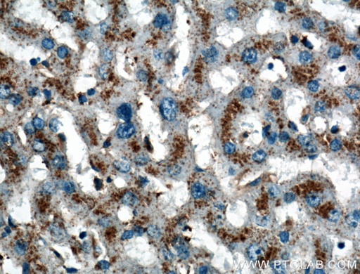 [27102-1-AP-150UL] LIMPII Polyclonal antibody