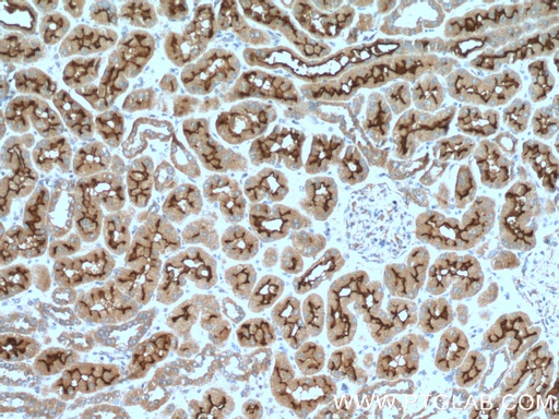 [27103-1-AP-20UL] PCDH24 Polyclonal antibody